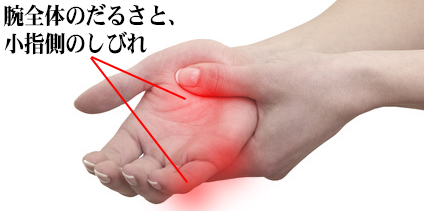 新宿で手の痺れや腕の腱鞘炎による痺れの治療改善